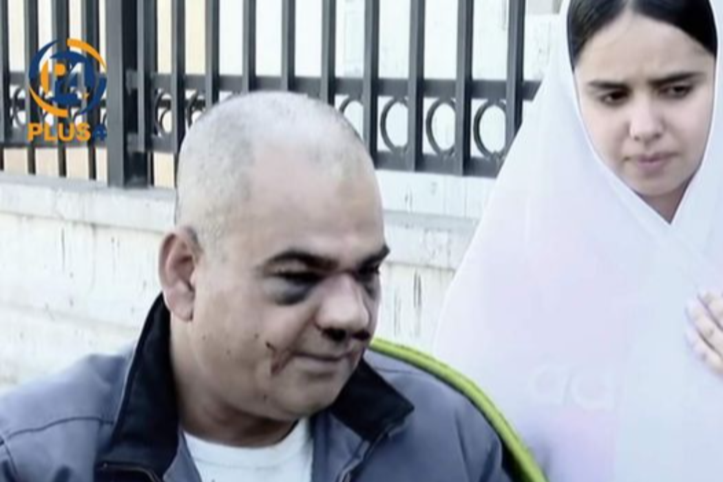 باريزةر
