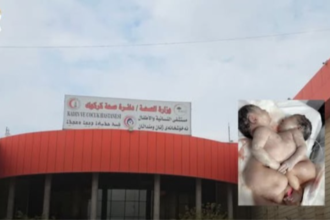 منداڵی دووانە